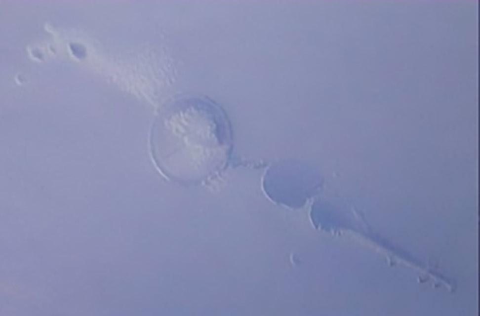 360-1-困气：注塑时带入空气